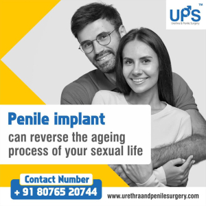 Penile Implants - Urethra and Penile Surgery.jpg